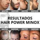 Kit 6 Loção Tônica Hair Power Spray Capilar Barba Cabelo Sobrancelha Masculino Feminino 360ml