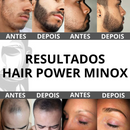 Loção Tônica Hair Power Spray Capilar Barba Cabelo Sobrancelha Masculino Feminino 60ml